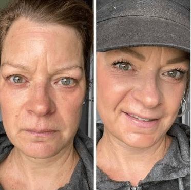 How to Refresh Your Appearance Without Surgery